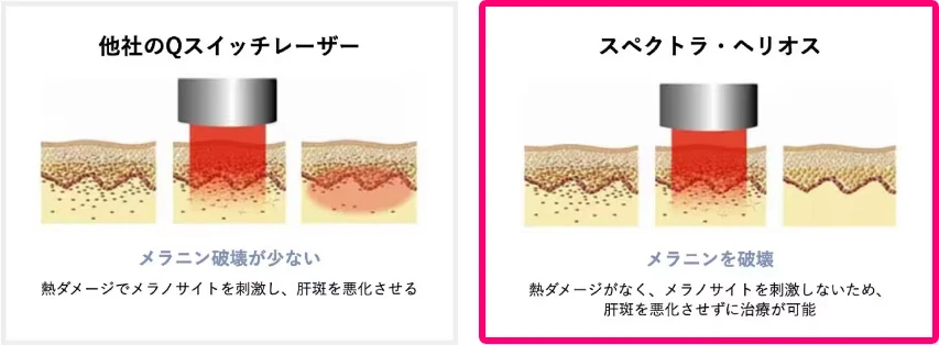 湘南美容クリニック